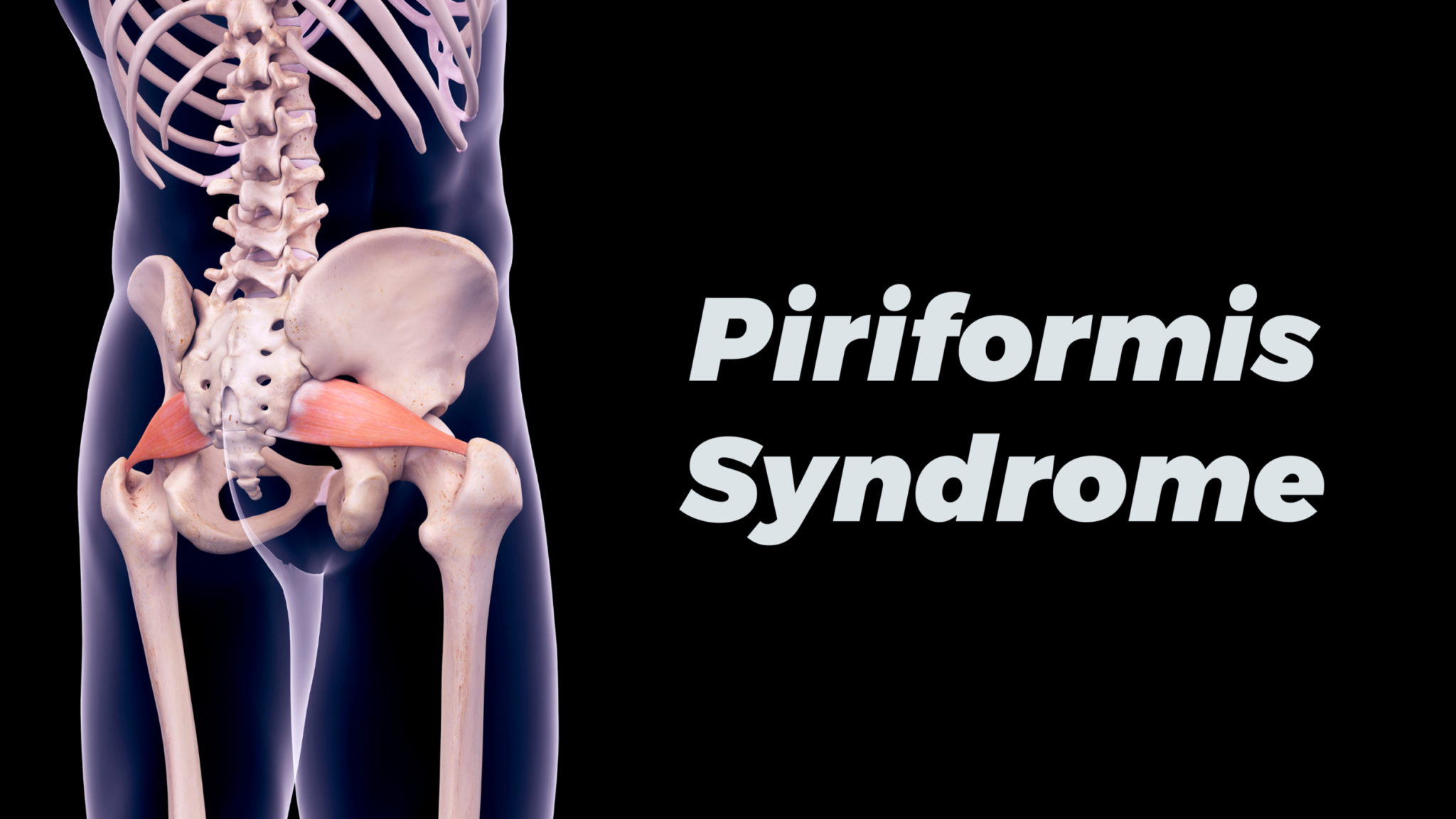 5 Effective Remedies For Piriformis Syndrome Get Fit Owasso